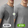 Antiperspirant Spray 50 ML | Stop Excessive Sweating Fast | No Sweat